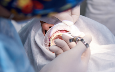 Paciente que obteve restituição por erro em cirurgia odontológica não pode exigir custeio de nova operação